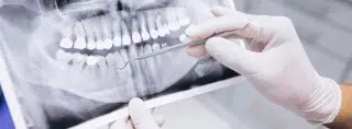 Curso de Auxiliar de Odontología